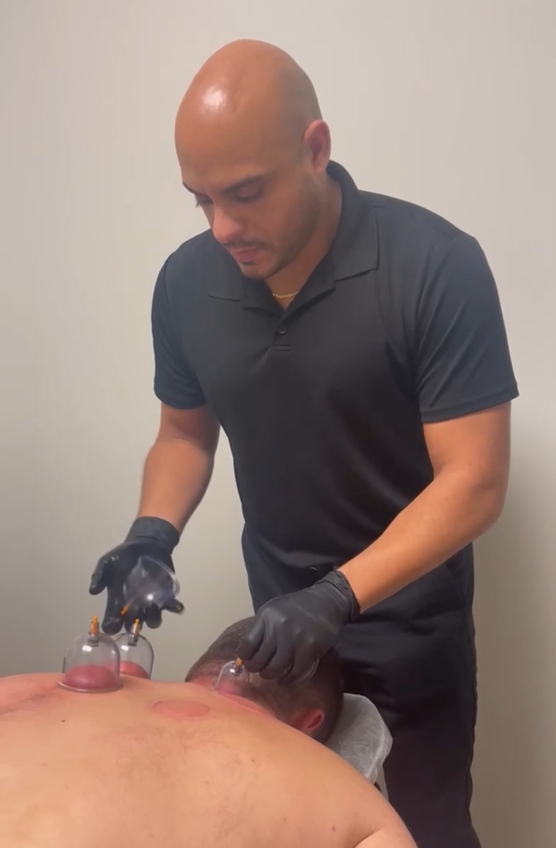 Medical cupping therapy on a patient's back